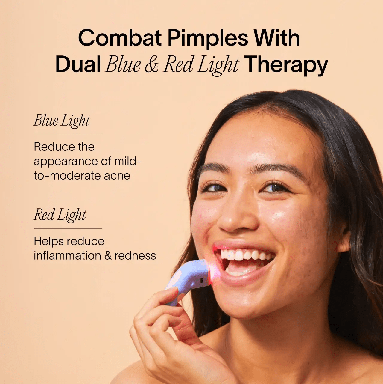 Bye Acne: 3 - Minute Pimple Spot Treatment - Lalka Beauty Co.