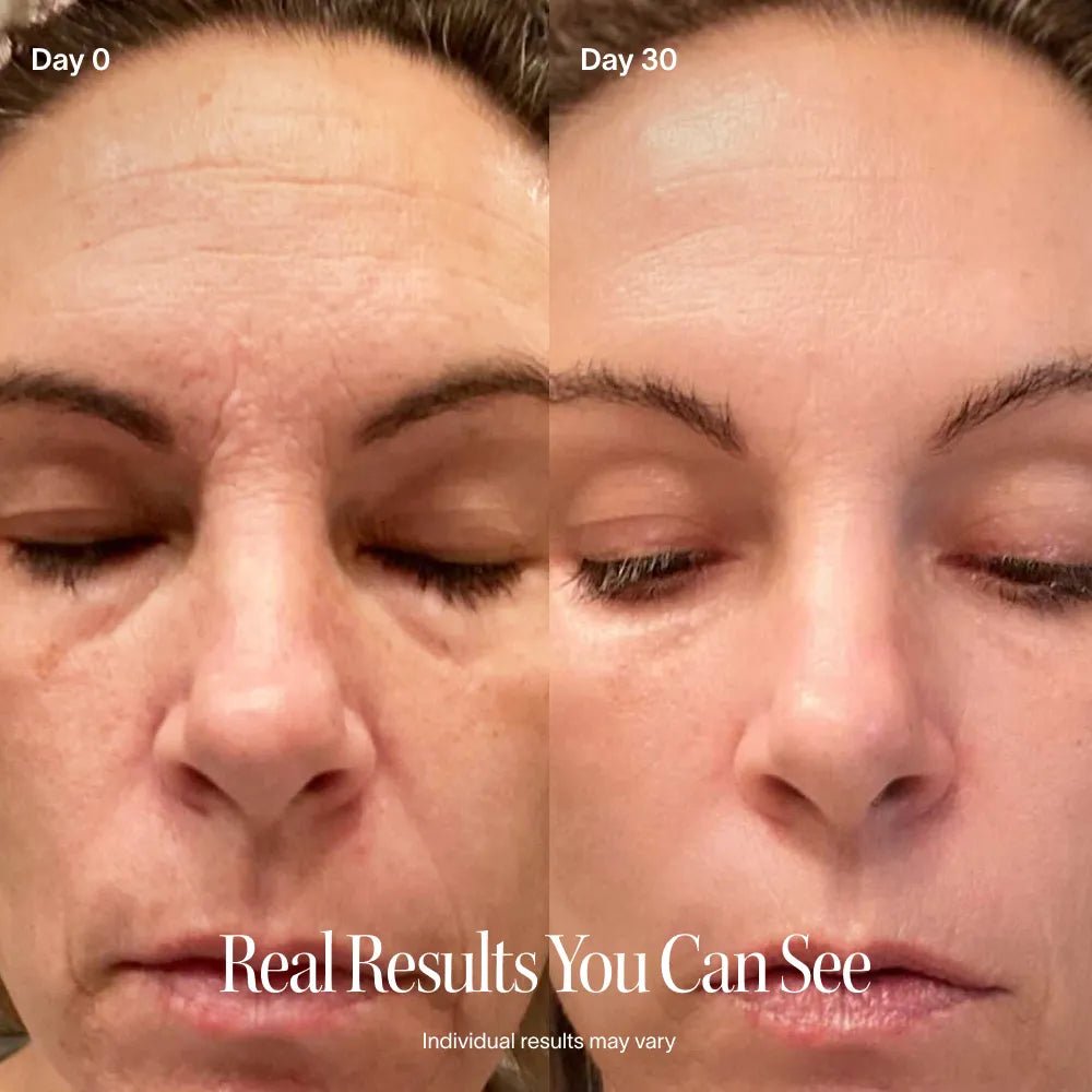 4 - in - 1 Red Light Therapy Wand & Activating Serum Kit - Lalka Beauty Co.