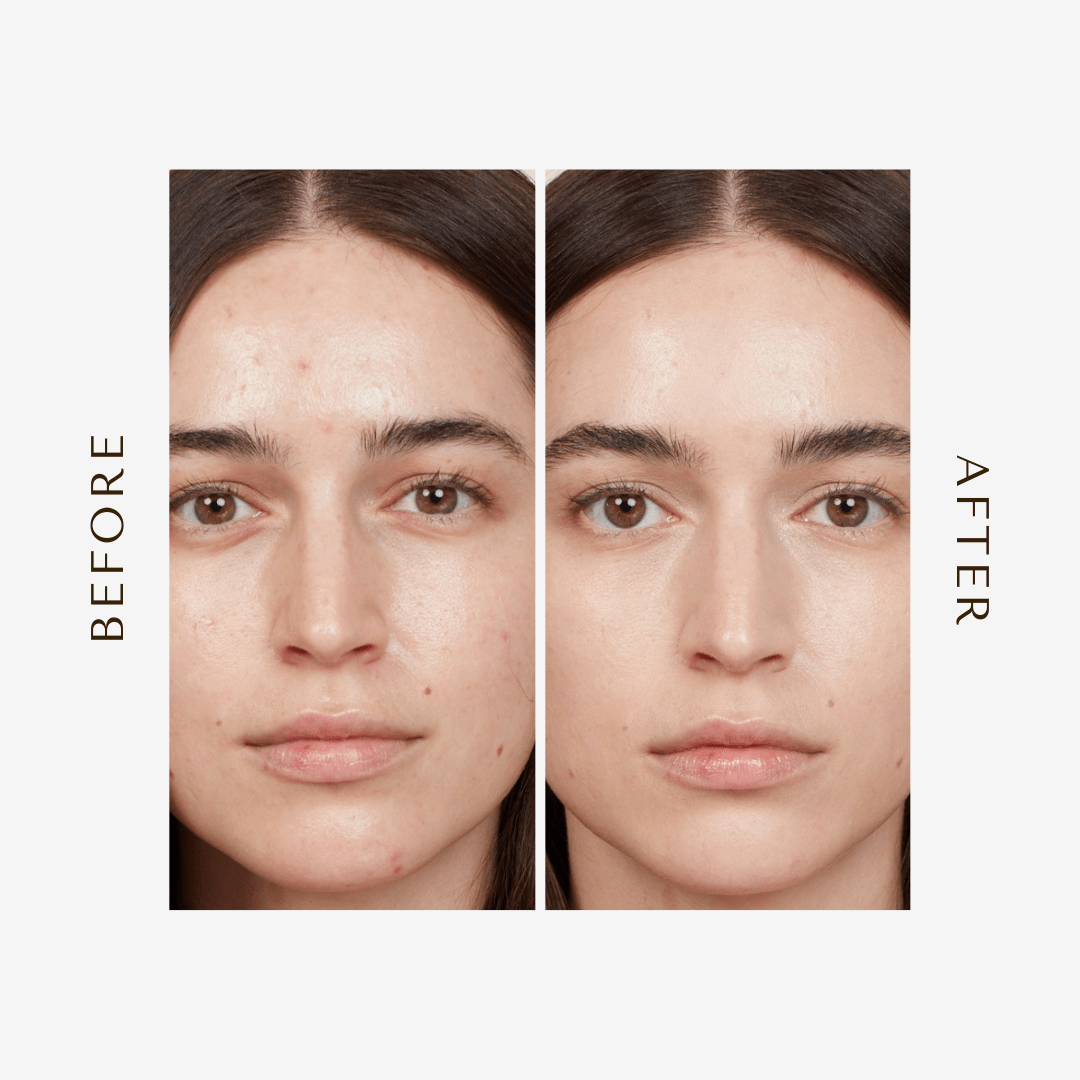 Blunder Cover Foundation Concealer - Lalka Beauty Co.