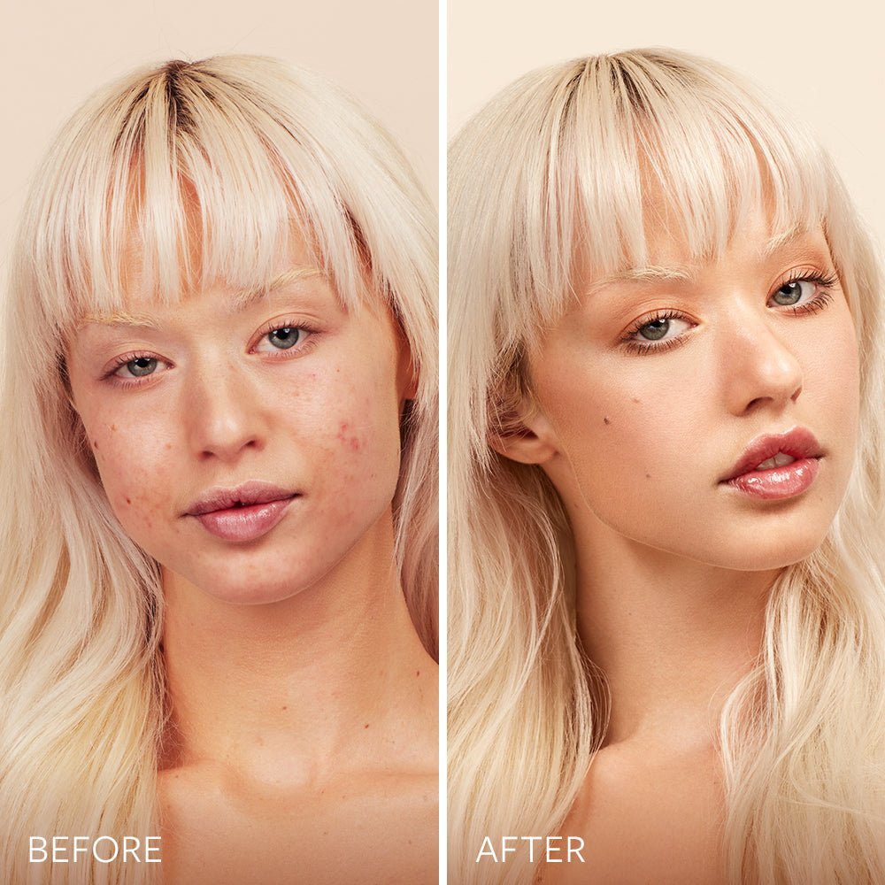 Blunder Cover Foundation Concealer - Lalka Beauty Co.