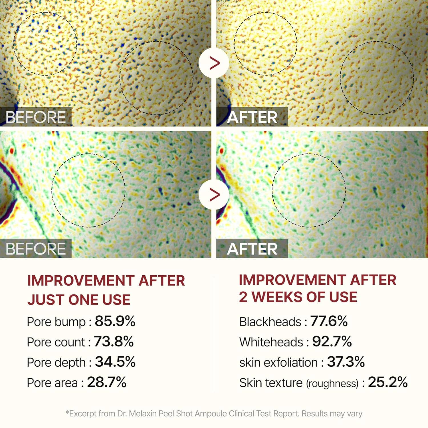 DR MELAXIN Peel Shot Glow White Rice Peeling Ampoule 80ml - Lalka Beauty Co.