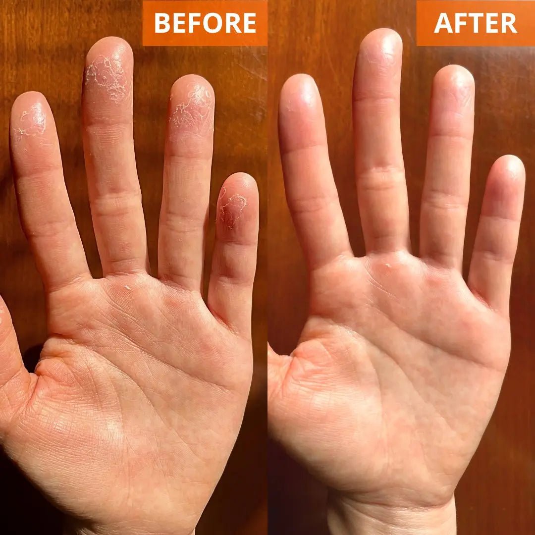 Moisturizing Skin Cream 4.4 Fl. Oz. Jar - Lalka Beauty Co.